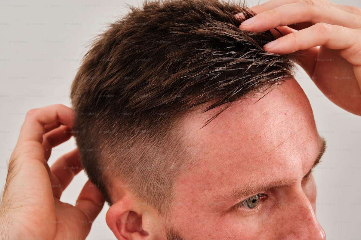 FUE Hair Transplant